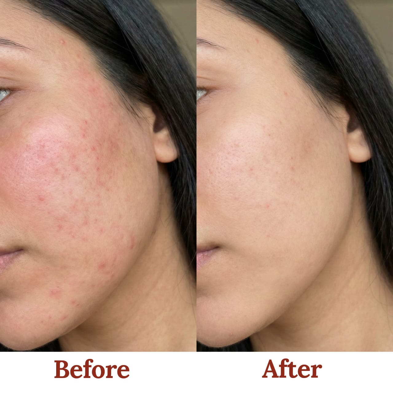 8 in 1 Antioxidant + Barrier Support Radiance Serum