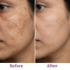Hushglow-The Ultimate Hyperpigmentation Corrector Serum